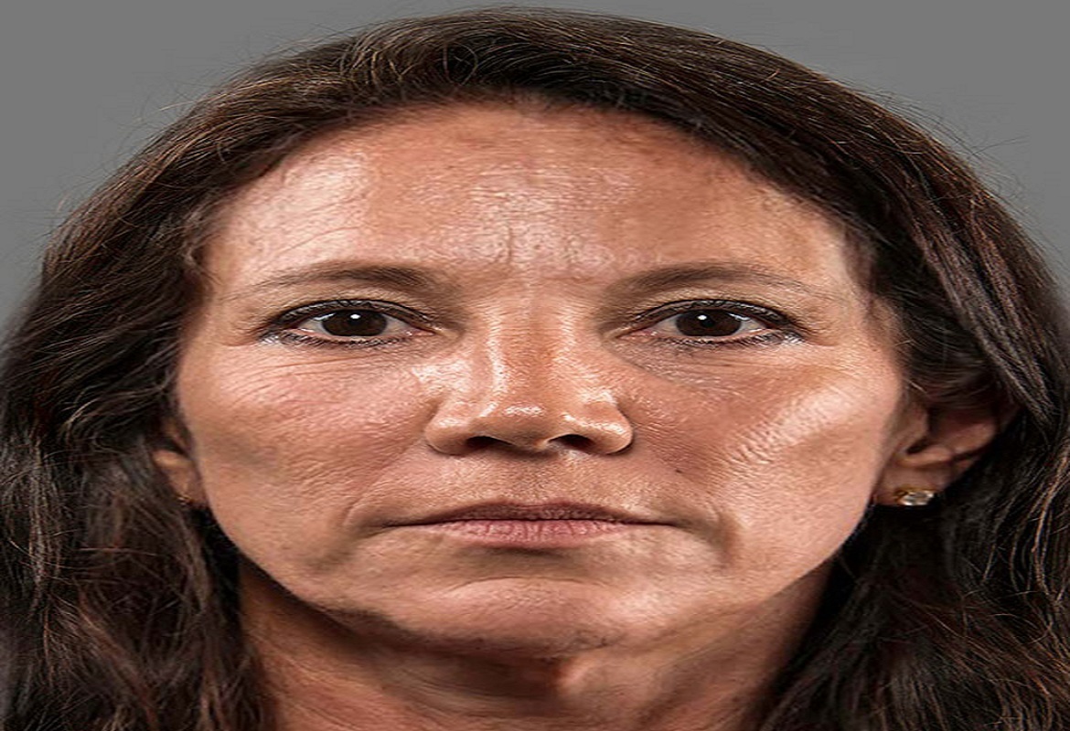 Embora todos os médicos possam fazer o procedimento, é essencial que estejam devidamente treinados e atualizados