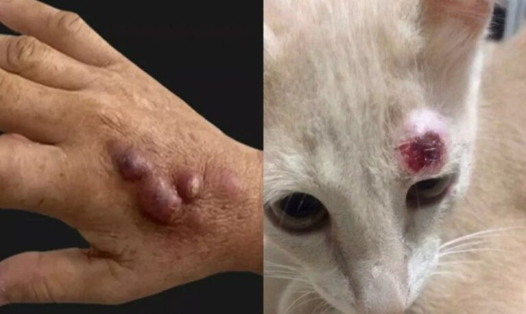 Entre 1998 e 2004, foram diagnosticados mais de 750 casos em seres humanos e 1.500 em gatos. Em 2011, houve 4.100 pessoas e 3.800 gatos.