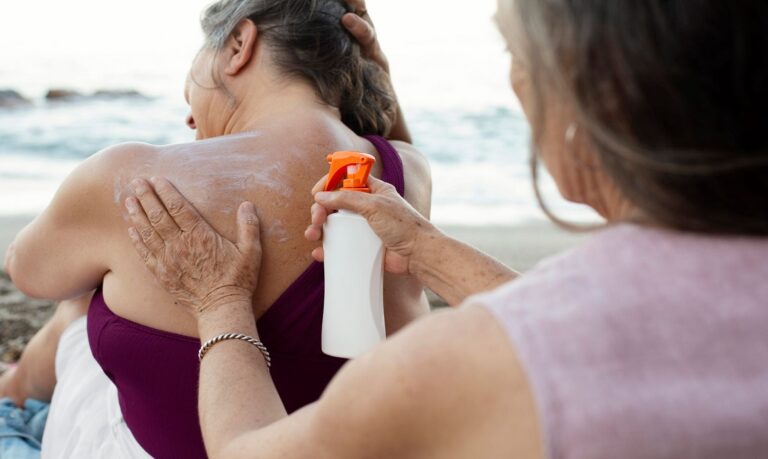 Dermatologistas recomendam protetor solar FPS 30 ou mais, reaplicado a cada 2 ou 3 horas.
