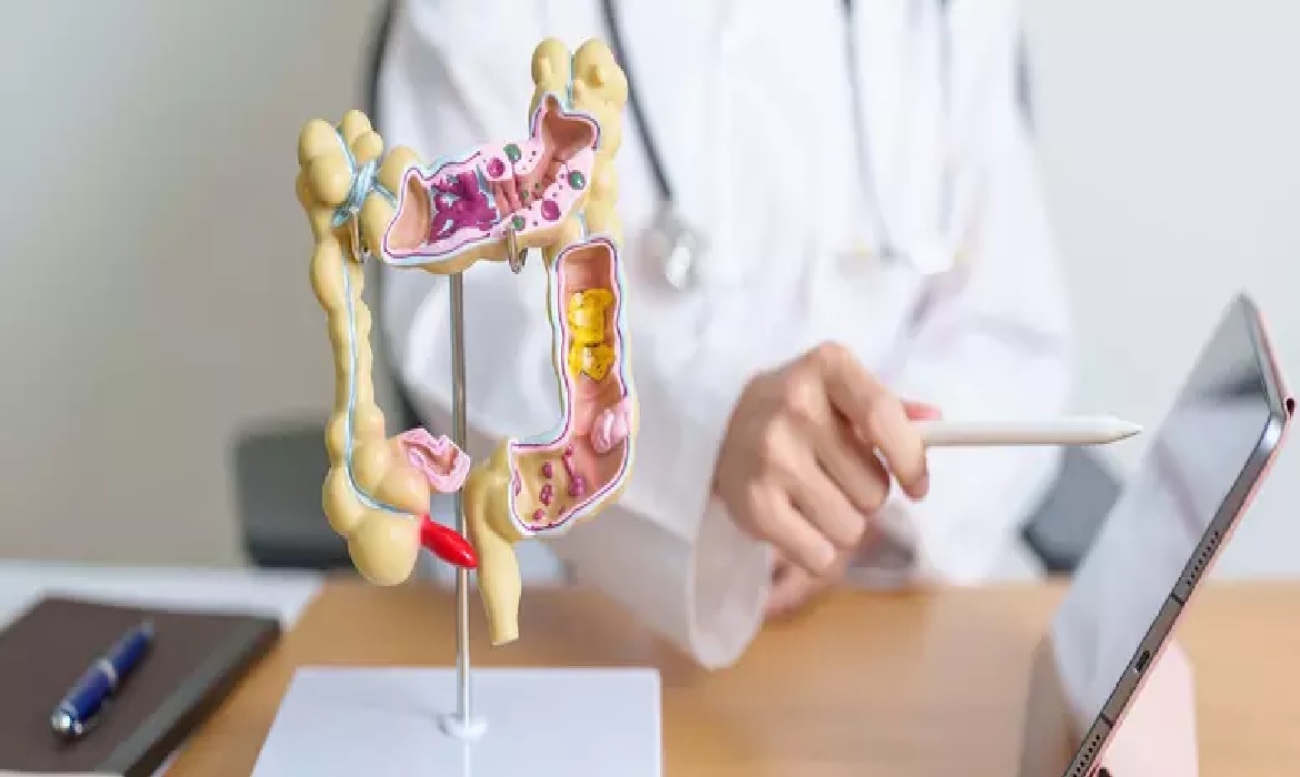 Estudos indicam que probióticos podem colaborar durante ou após o tratamento do câncer colorretal, sempre com acompanhamento médico adequado.