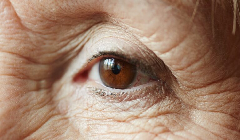 Crescimento abaixo da meta global preocupa especialistas.